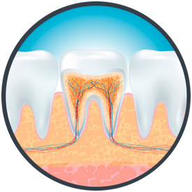 Root Canal Therapy Dubuque